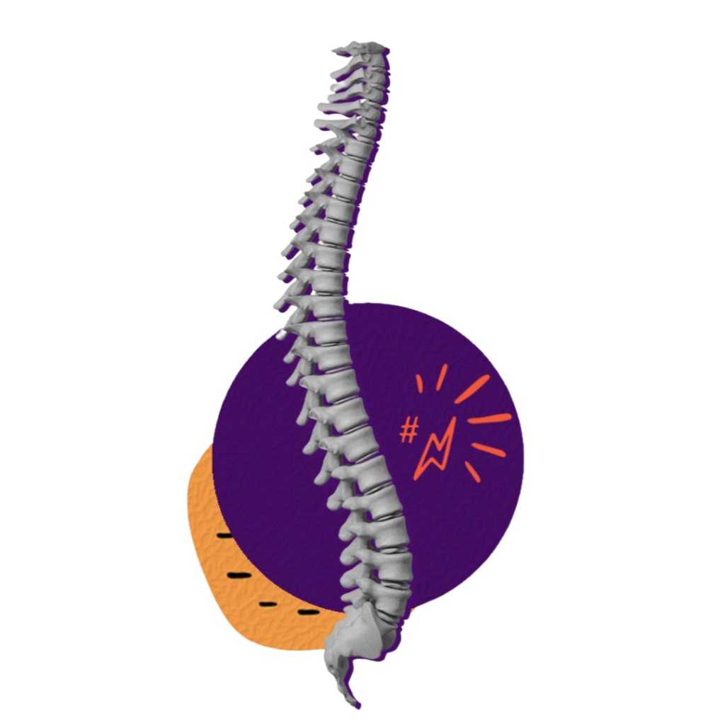 cirurgia de coluna